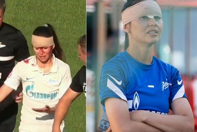 Tabrakan Kepala dengan Lawan, Pemain Timnas Wanita Rusia Ini Berlumuran Darah dan Diperban