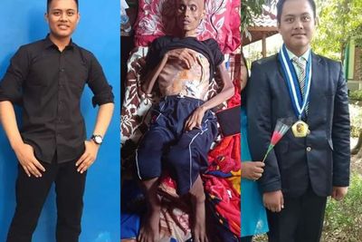 Bantuan Netizen Dibutuhkan untuk Fajar, Pria 20 Tahun yang Idap Kanker hingga Sangat Kurus