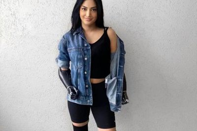 Wanita Cantik Ini Kehilangan Tangan dan Kakinya karena Infeksi Penyakit Langka