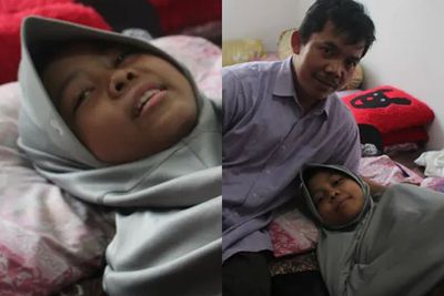 Bantu Azkia! Hafidzah 15 Tahun Penderita TBC Tulang Belakang, Ayah Cuma Pekerja Serabutan