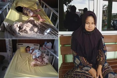 Pilu Ibu Bocah Kakak-Beradik Penderita Penyakit Kulit: Dari Lahir Mereka Tak Sembuh-Sembuh