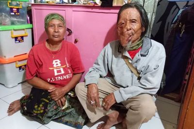 Pria Asal Bandung Ini Idap Tumor Neurofibromatosis, Pekerjaan Cuma Pengasah Pisau Keliling