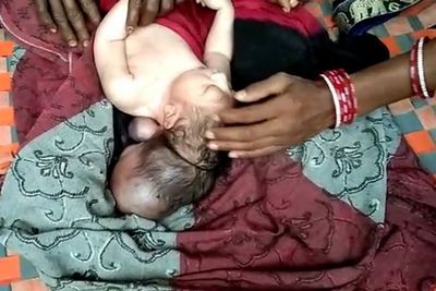 Bayi Berkepala Tiga di India Ini Diklaim Sebagai Inkarnasi Tuhan Oleh Warga