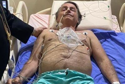 Cegukan Selama 10 Hari, Presiden Brasil Dirawat di Rumah Sakit
