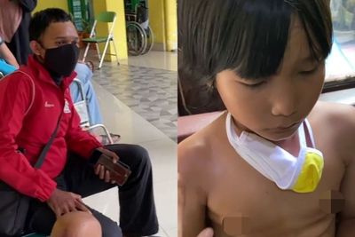 Arogan! Driver Ojol Tabrak Bocah Sampai Tulang Patah, Ngaku Marinir, Ternyata Marinir KW