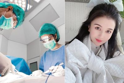 Gadis Cantik di China Tewas setelah Operasi Plastik yang Dijalaninya Gagal