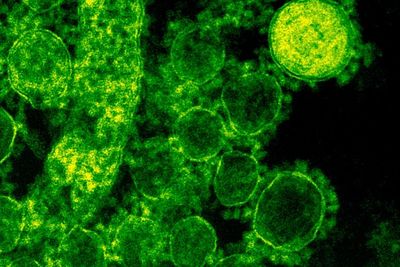 Studi: Virus yang Menginfeksi Bakteri dapat Mengubahnya Menjadi Superbug