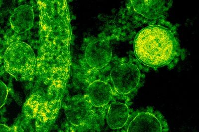 Peneliti Temukan Bahwa Virus Flu Biasa Berasal Lebih dari 700.000 Tahun Lalu!