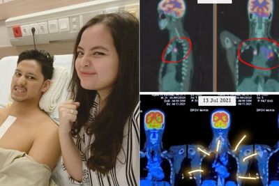 Suami Tasya Kamila Sembuh dari Kanker Getah Bening Setelah Berjuang 6 Bulan
