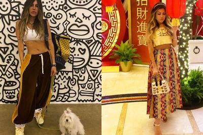 Model Asal Brasil Ini Dilarikan ke Rumah Sakit, Karena Keracunan Usai Lakukan Filler