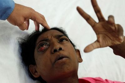 Mengenal Penyakit Jamur Hitam yang Terjadi di India!