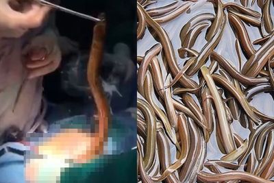 Pria Ini Hampir Tewas Setelah Memasukkan Belut ke dalam Anus untuk Sembuhkan Sembelit