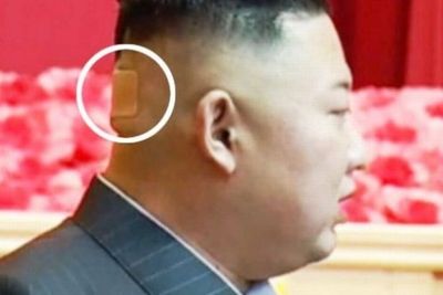 Kim Jong Un Bikin Rakyatnya Khawatir Gegara Pakai Plaster di Belakang Kepala