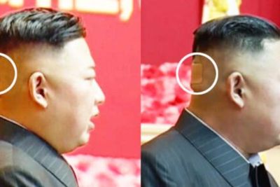 Kepala Kim Jong-un Diplester, Picu Rumor Jika Dirinya Mengidap Penyakit