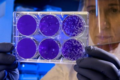 Batwoman China Peringatkan Varian Covid-19 Mematikan Akan Menyebar ke Seluruh Dunia