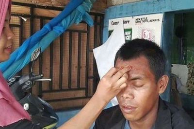 Lebih Percaya Khasiat Kunyit Ketimbang ke Rumah Sakit, Warga Singkil Alami Demam Massal