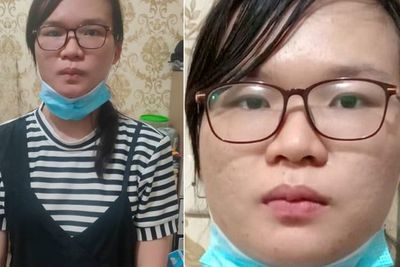 Sosok Mery Anastasia, Dokter Hamil yang Bakar Bengkel Pacarnya, Tak Direstui Ortu Pacar