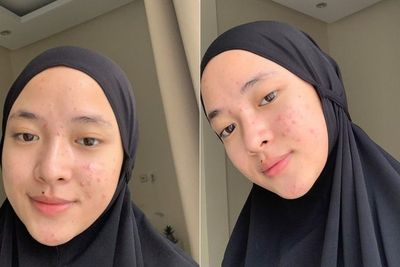 Nissa Sabyan Pamer Wajah Berjerawat, Netizen Malah Bahas Azab
