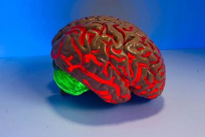 Artificial Intelligence Berhasil Mendeteksi Demensia Sebelum Gejala Muncul