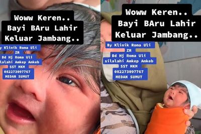 Heboh Bayi Baru Lahir Punya Rambut Panjang, Netizen: Ada Salon Dalam Perut!