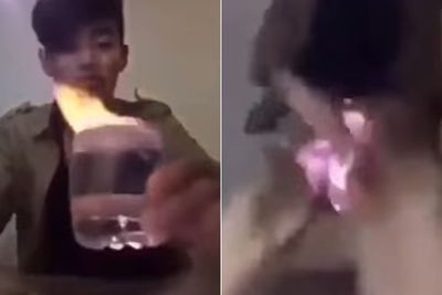 Sok Jago Main Api, Alat Kelamin Pria Ini Terbakar Kena Tumpahan Minyak, Jingkrak-Jingkrak