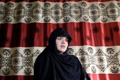 Cerita Wanita yang Matanya Ditembak Taliban Mengklaim Perempuan Diberi Umpan ke Anjing