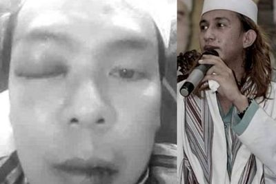 Foto Ryan Jombang Bonyok & Muntah Darah Dihajar Bahar bin Smith, Dianiaya Saat Mau Salat