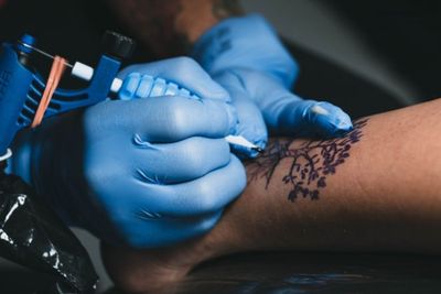 Dokter Sebut Hilangkan Tato dengan Bantuan Laser Adalah Prosedur yang Aman