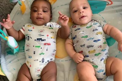 Lahirkan Bayi Kembar dengan Warna Kulit Berbeda, Ibu Ini Sempat Terkejut