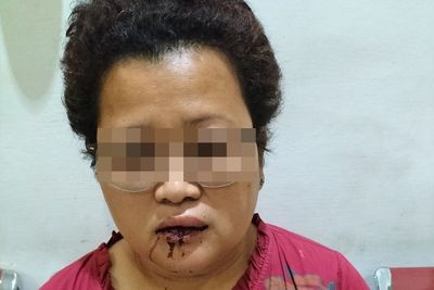 Duh! Lurah Wanita di Siantar Dianiaya Oknum Babinsa TNI, Hidung dan Mulut Sampai Berdarah