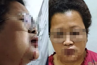 Oknum TNI Pukuli Lurah Asuhan, Walmaria Dimintai Keterangan Denpom I Pematangsiantar