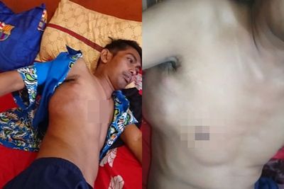 Viral Pria di Cianjur Lumpuh Usai Vaksin COVID-19 Dosis Ke-2, Alami Pusing & Muntah-Muntah
