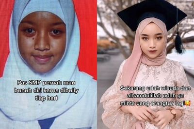 Pernah Dibully Sampai Mau Bunuh Diri, Wanita Ini Tunjukkan Dirinya Bisa Bangkit