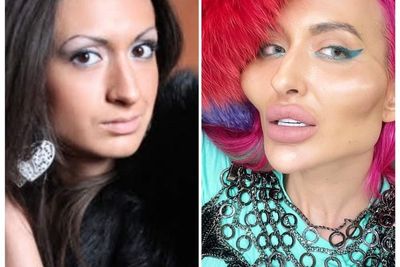 Terobsesi Jadi Cantik, Wanita Ini Rela Habiskan Rp300 Juta untuk Perawatan
