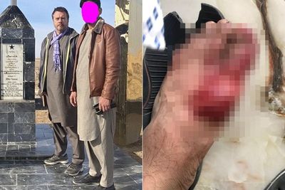 Jurnalis AS Ceritakan Ngerinya Situasi di Afghanistan, Bertaruh Nyawa Sampai Berdarah
