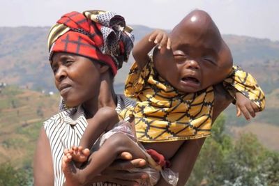 Pria Keji Minta Istrinya Bunuh Anak Cacat yang Dianggap Setan hingga Disebut Alien