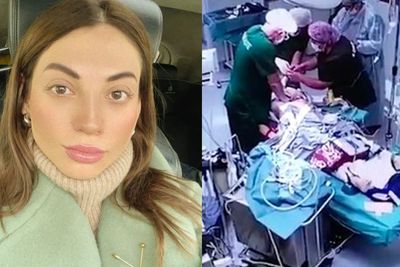Tragis, Influencer Ini Meninggal saat Prosedur Operasi Hidung di Klinik Elit di Rusia