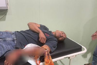 Sadis! Seorang Pria Dipalak di Papua dan Dianiaya Pakai Kapak