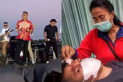 Bupati Sikka Bebas Nyanyi Tanpa Masker, Warga Langgar PPKM Malah Dipukul Petugas