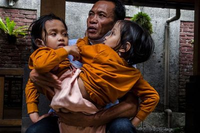 FOTO: Anak Kembar Siam Asal Garut