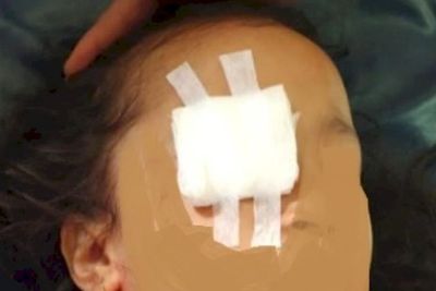 Derita Bocah Perempuan 6 Tahun, Bola Matanya Dicongkel Ibu-Ayahnya untuk Pesugihan di Gowa
