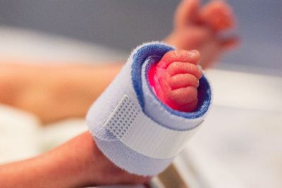 Indonesia Tempati Urutan ke-5 Negara dengan Jumlah Bayi Prematur Terbanyak di Dunia