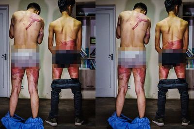 Mengerikan, Foto Tubuh 2 Jurnalis Penuh Darah Luka Gores, Diduga Korban Serangan Taliban