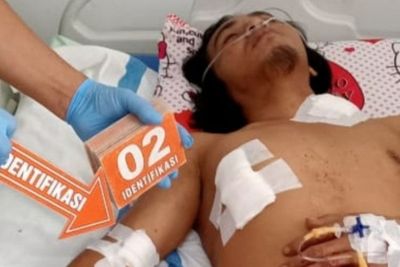 Polres Toba Selidiki Kasus Penganiayaan Warga Lumban Dolok, Korban Alami Luka Bacok