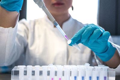 File Rahasia Bocor! AS Diduga Biayai Penelitian Virus Corona di Lab Wuhan