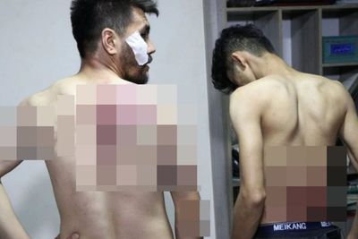 2 Wartawan Afghanistan Dipukuli dalam Tahanan Usai Liput Demo di Kabul