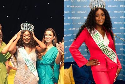 Cerita Miss Irlandia yang Kerap Mendapat Komentar Rasis karena Warna Kulitnya