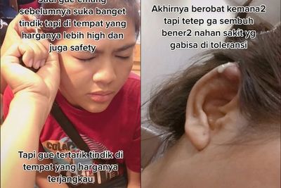 Wanita Ini Bagikan Kisahnya yang Tergiur Tindik Telinga Murah, Endingnya Malah Buat Nyesal