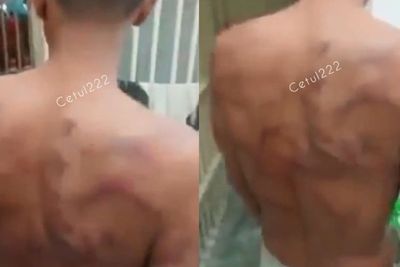 Viral Dugaan Penganiayaan Napi di Lapas Kelas 1 Medan, Tubuh Napi Penuh Luka Memar