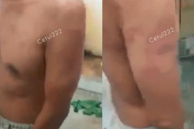 Napi Lapas Kelas 1 Medan Ngaku Diperas Rp40 Juta Rupiah, Dipukul Petugas Kalau Tak Memberi